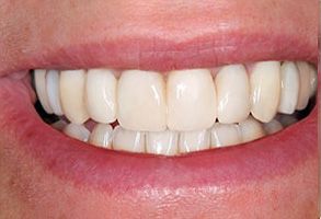 Fore Dental Care | Dentures, Periodontal Treatment and Teeth Grinding