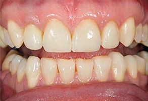 Fore Dental Care | Dentures, Pediatric Dentistry and Oral Cancer Screening